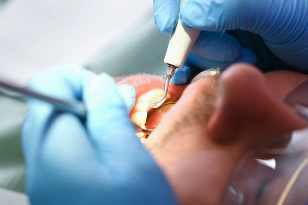 Fast & Reliable Emergency Dental Services in NH