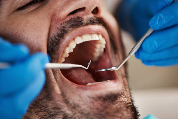 Best Emergency Tooth Extraction in Portsmouth, NH