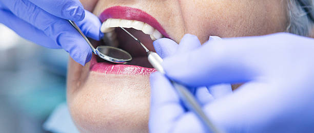 Best Emergency Treatment for Toothache in Portsmouth, NH